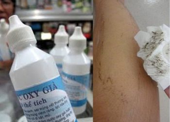 Tẩy lông bằng oxy già hiệu quả không? Lưu ý khi tẩy lông bằng oxy già