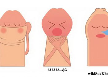 Bệnh bao quy đầu: Khái niệm, nguyên nhân, dấu hiệu, điều trị và cách phòng ngừa