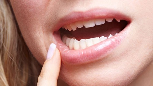 Bệnh lậu có thể mắc cả ở miệng