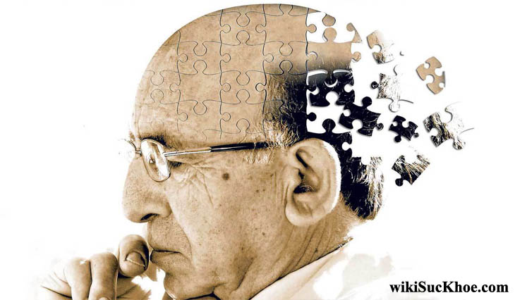 Bệnh mất trí nhớ: Khái niệm, nguyên nhân, triệu chứng, điều trị và cách ngăn ngừa