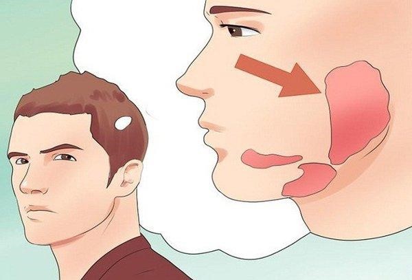 Bệnh nhân từng bị quai bị cũng có khả năng nhiễm bệnh cao