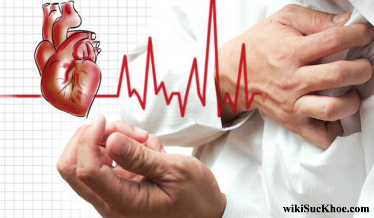 Bệnh tim mạch: Khái niệm, nguyên nhân, triệu chứng và cách phòng ngừa