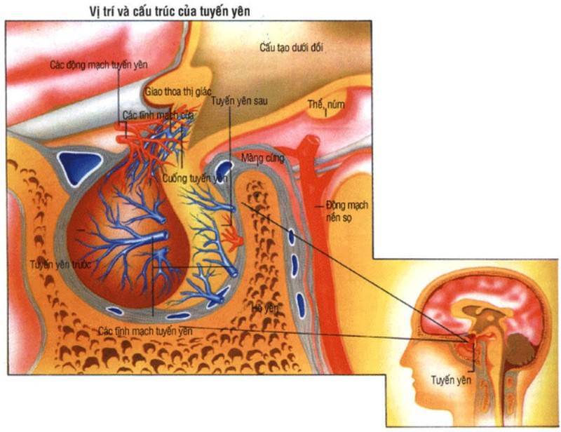 Bệnh u tuyến yên là gì?