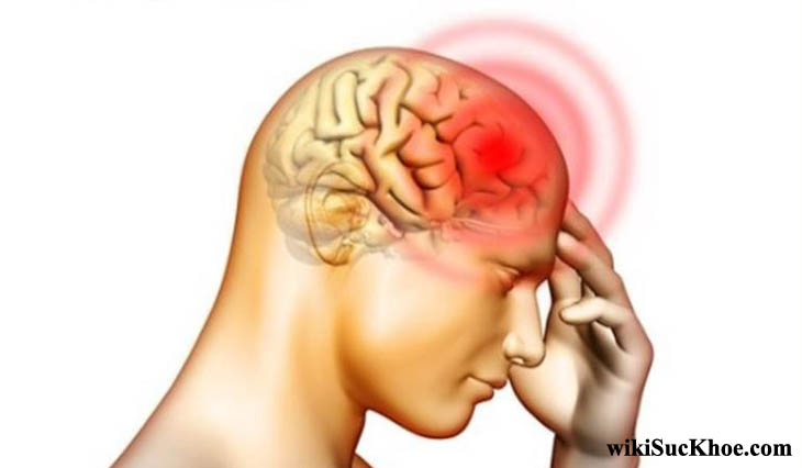 Bệnh viêm màng não mô cầu: Khái niệm, nguyên nhân, triệu chứng, phòng ngừa