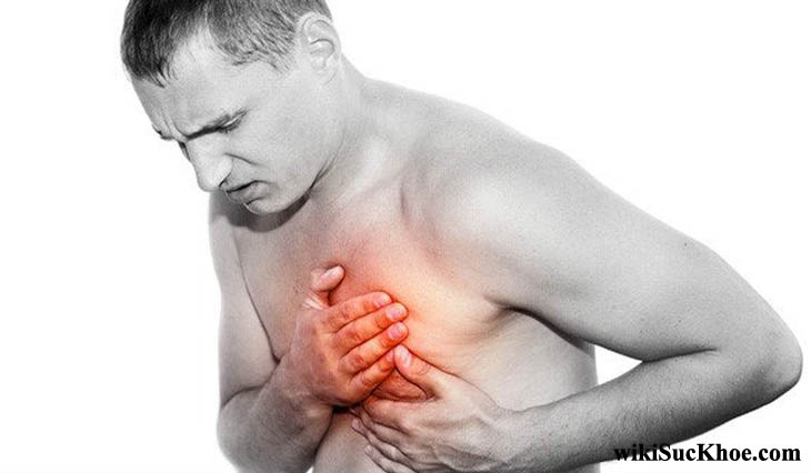 Bệnh viêm màng ngoài tim: Khái niệm, nguyên nhân, triệu chứng,điều trị và cách phòng ngừa