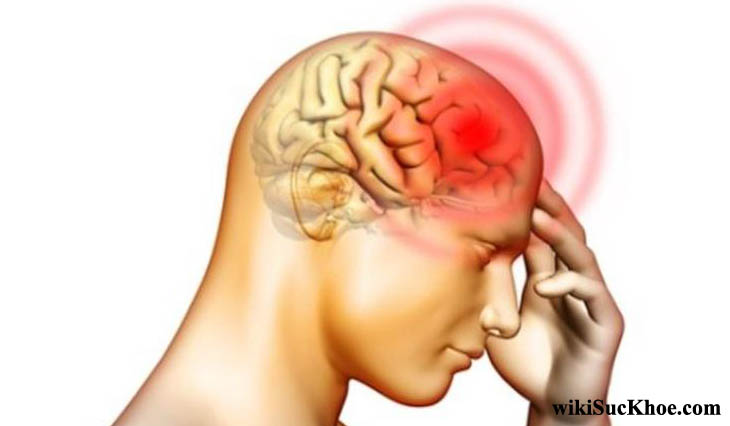 Bệnh viêm màng não do liên cầu: Khái niệm, nguyên nhân, triệu chứng,điều trị và phòng ngừa