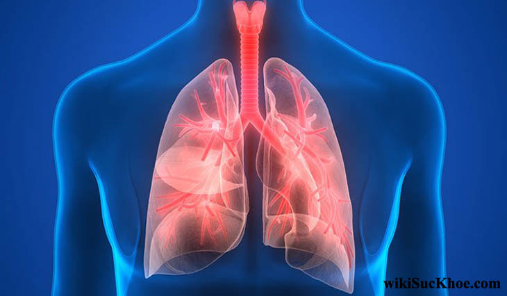 Bệnh viêm phổi: Khái niệm, nguyên nhân, triệu chứng, phòng ngừa