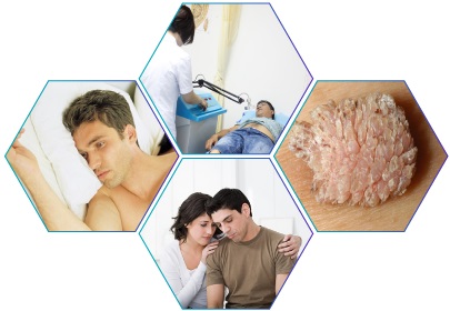 Bệnh xã hội là gì?