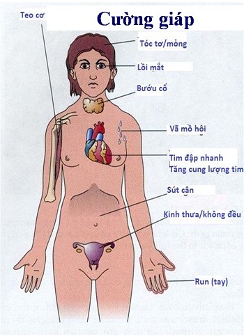 Biểu hiện của bệnh cường giáp ở nữ giới