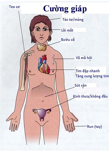 Biểu hiện của bệnh cường giáp ở nữ giới