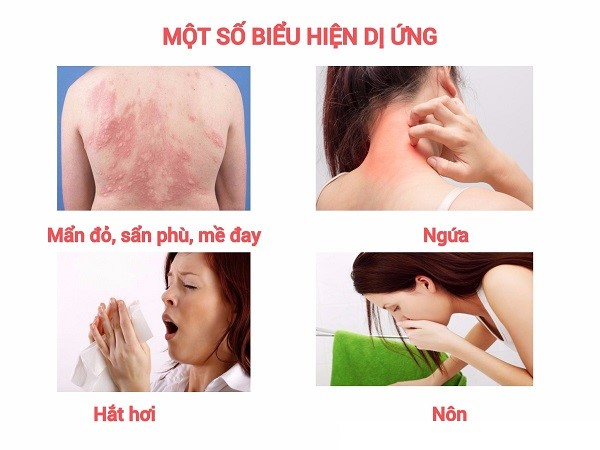 Biểu hiện của bệnh dị ứng