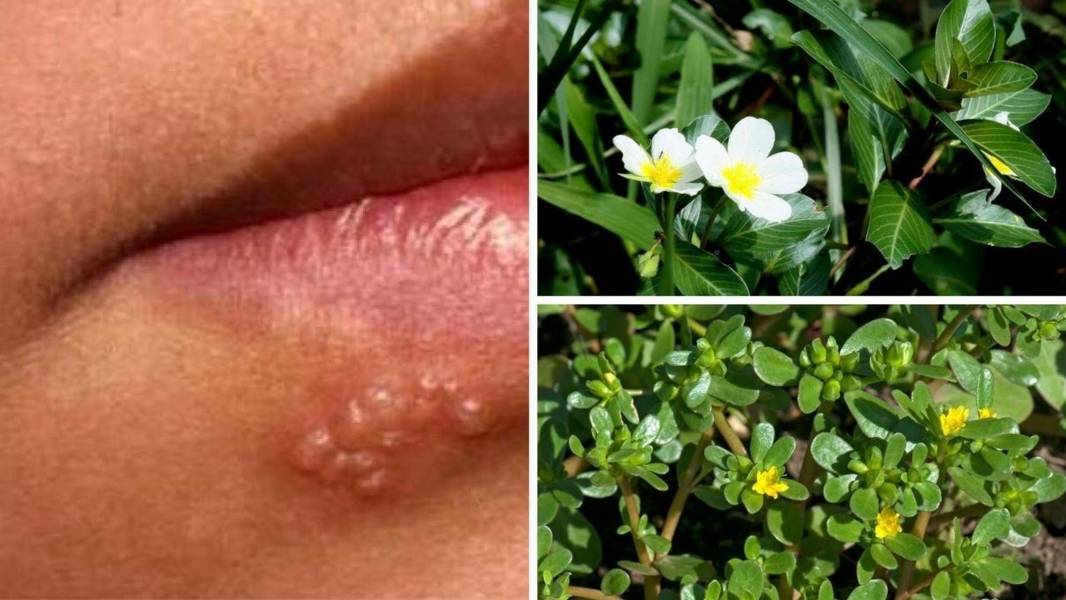 Cách phòng ngừa bệnh