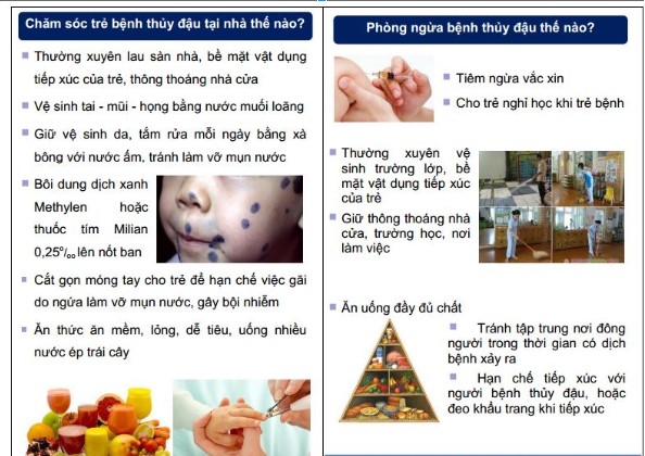 Chăm sóc và phòng ngừa thủy đậu