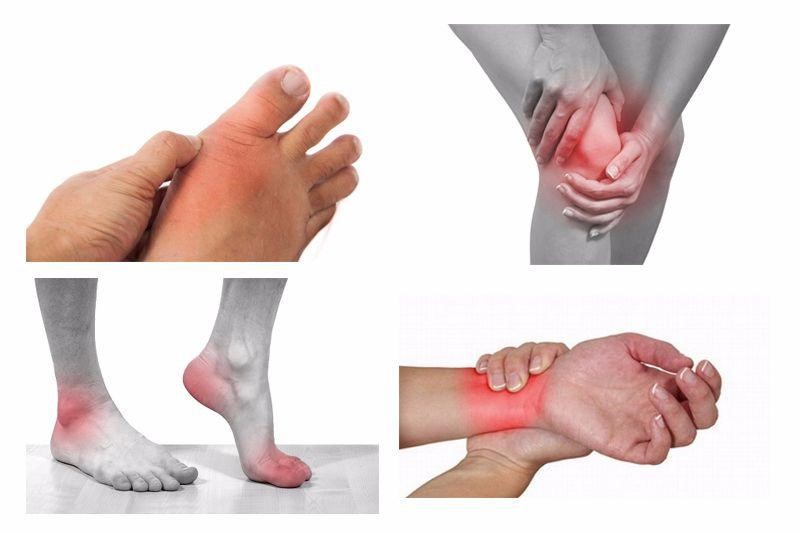 Những dấu hiệu nhận biết bệnh thấp khớp