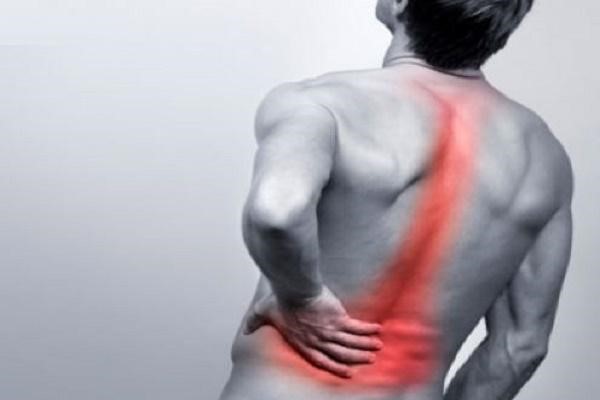 Đau lưng do thoát vị đĩa đệm cột sống