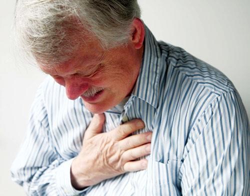 Đau thắt ngực - dấu hiệu xơ vữa động mạch
