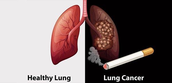 Thuốc lá gây hại tới sức khỏe của mọi người