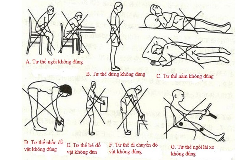 Nguyên nhân dẫn đến tình trạng thoái hóa đốt sống cổ