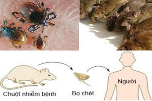 Nguyên nhân gây bệnh dịch hạch
