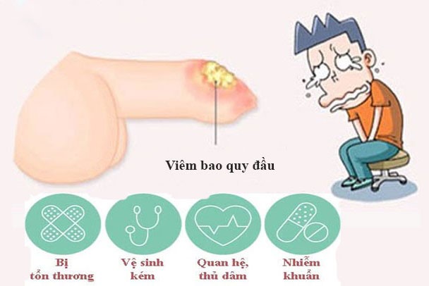 Các nguyên nhân gây nên viêm bao quy đầu