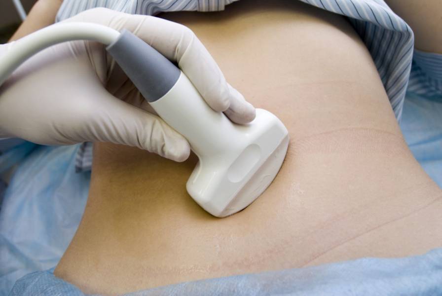 Các phương pháp có thể trị bệnh ung thư buồng trứng