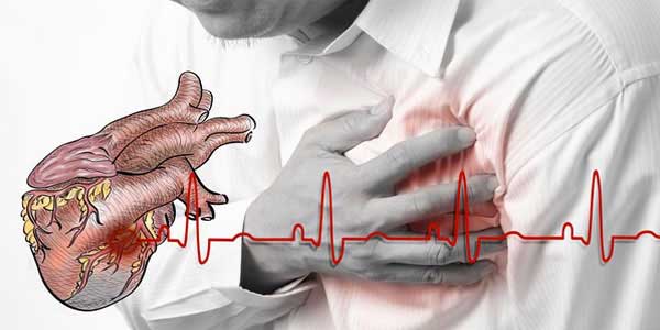Tổng quan về bệnh suy tim: nguyên nhân, triệu chứng và cách hỗ trợ điều trị tại nhà hiệu quả