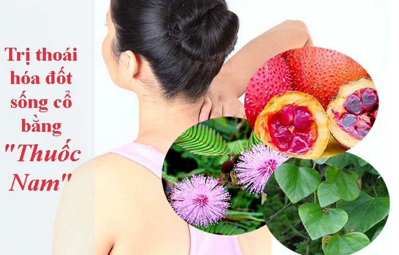 Trị thoái hóa đốt sống cổ bằng thuốc nam