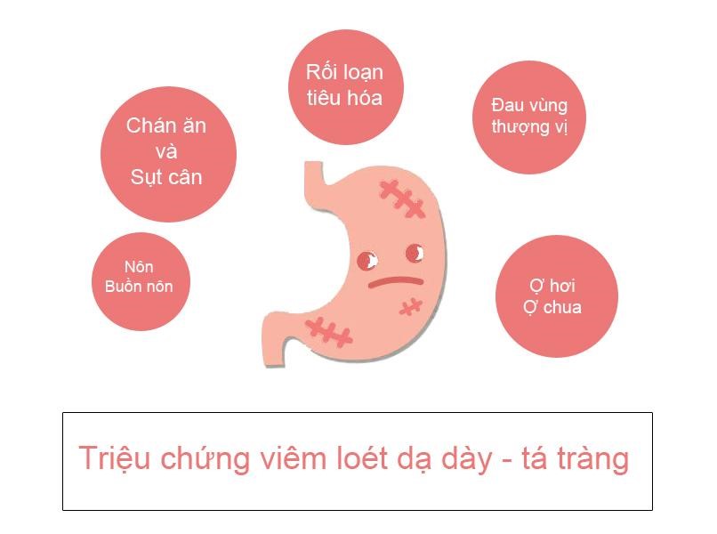 Triệu chứng của bệnh đau dạ dày