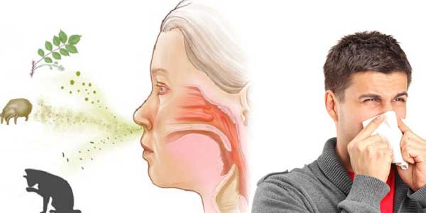 Viêm mũi dị ứng và các cách điều trị tại nhà